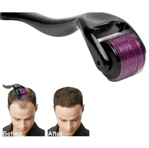 Derma Roller 540 Titanium Needles - Anti-Aging Skin & Hair Growth Tool